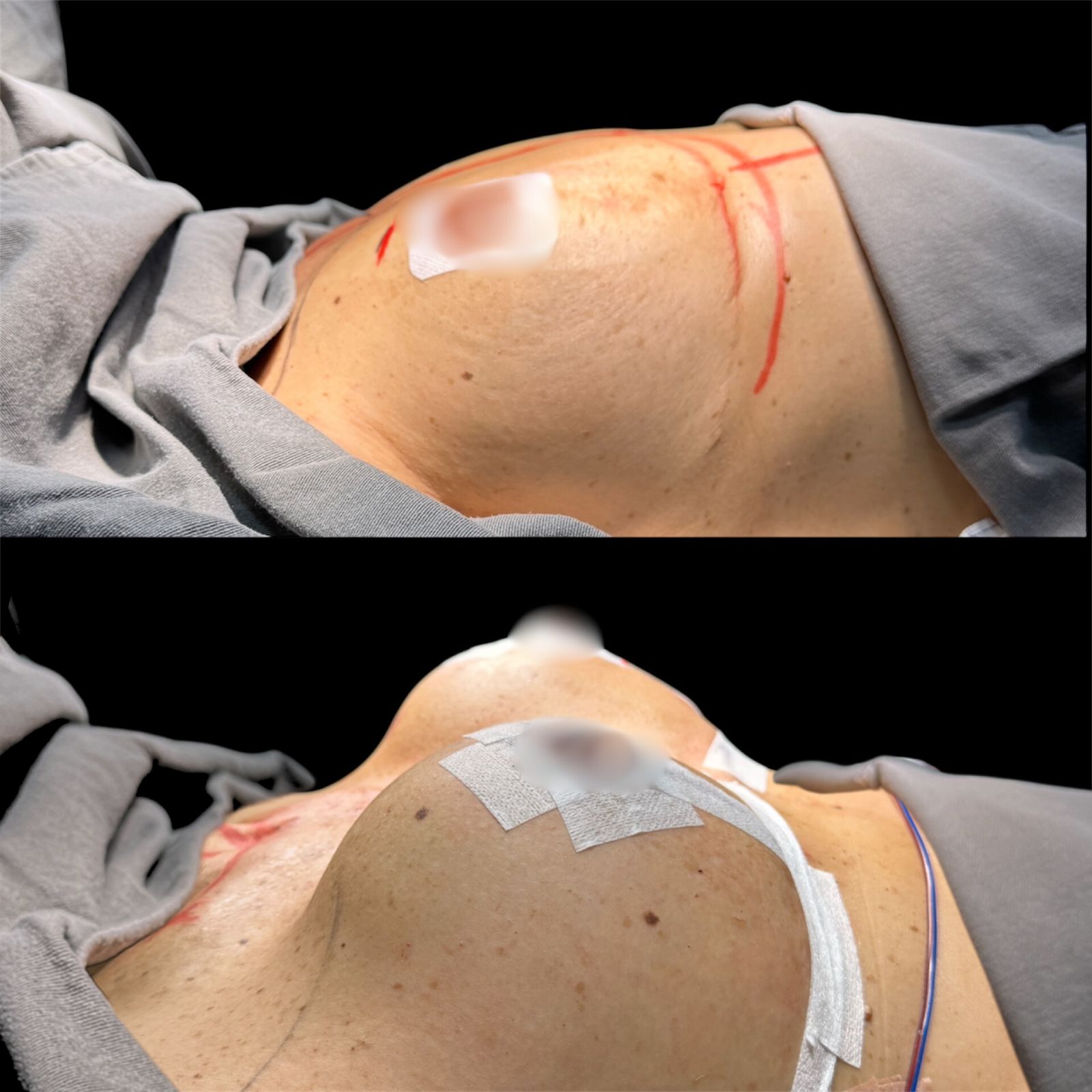 cirurgiao-plastico-cwb